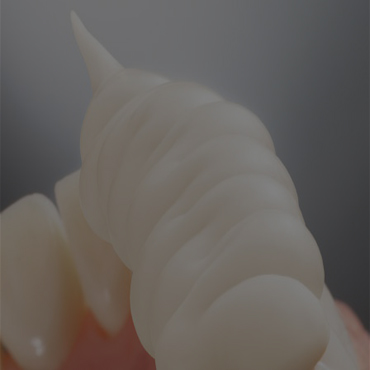 > Côntrole de L'occlusion
