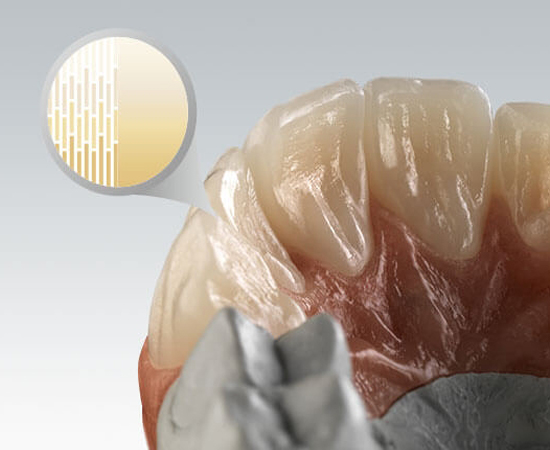 Ceramill® zolid fx multilayer